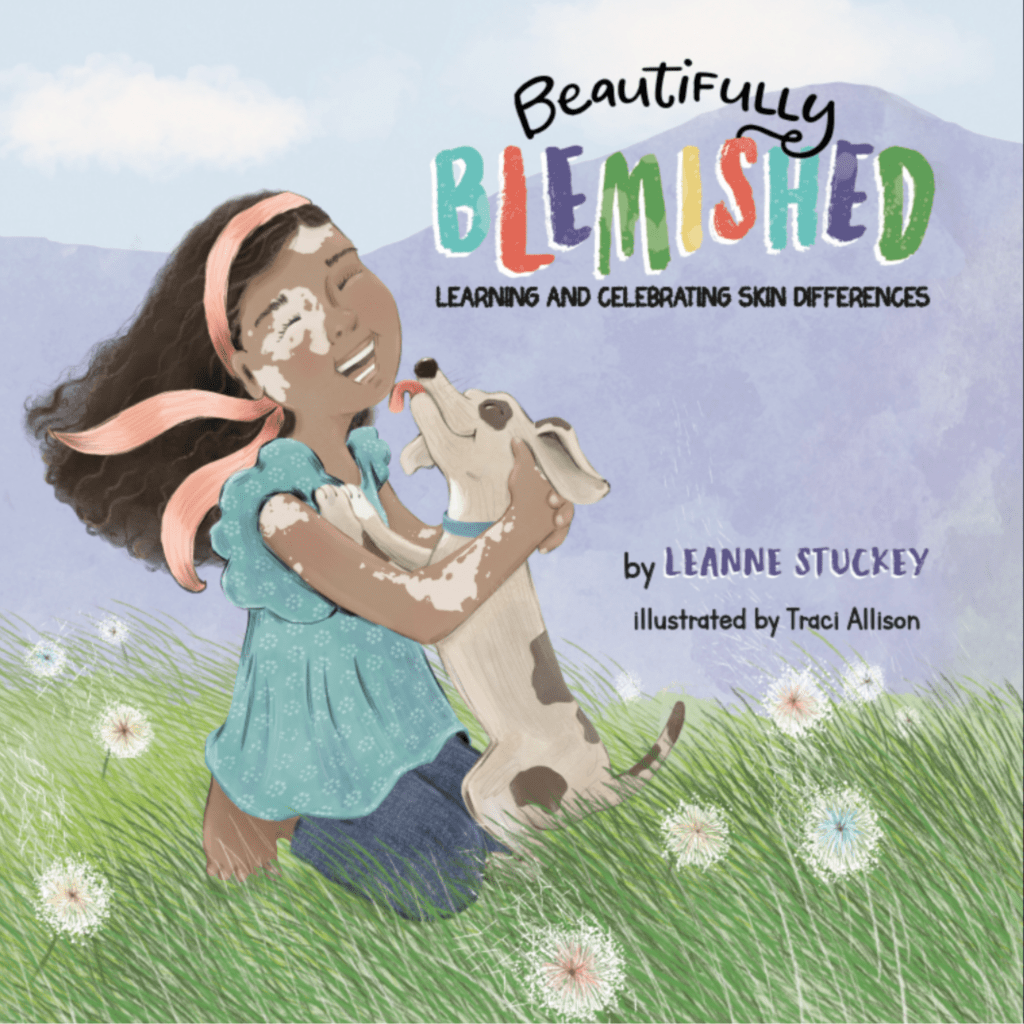 𝘽𝙚𝙖𝙪𝙩𝙞𝙛𝙪𝙡𝙡𝙮 𝘽𝙡𝙚𝙢𝙞𝙨𝙝𝙚𝙙: 𝙇𝙚𝙖𝙧𝙣𝙞𝙣𝙜 𝙖𝙣𝙙 𝘾𝙚𝙡𝙚𝙗𝙧𝙖𝙩𝙞𝙣𝙜 𝙎𝙠𝙞𝙣 𝘿𝙞𝙛𝙛𝙚𝙧𝙚𝙣𝙘𝙚𝙨.