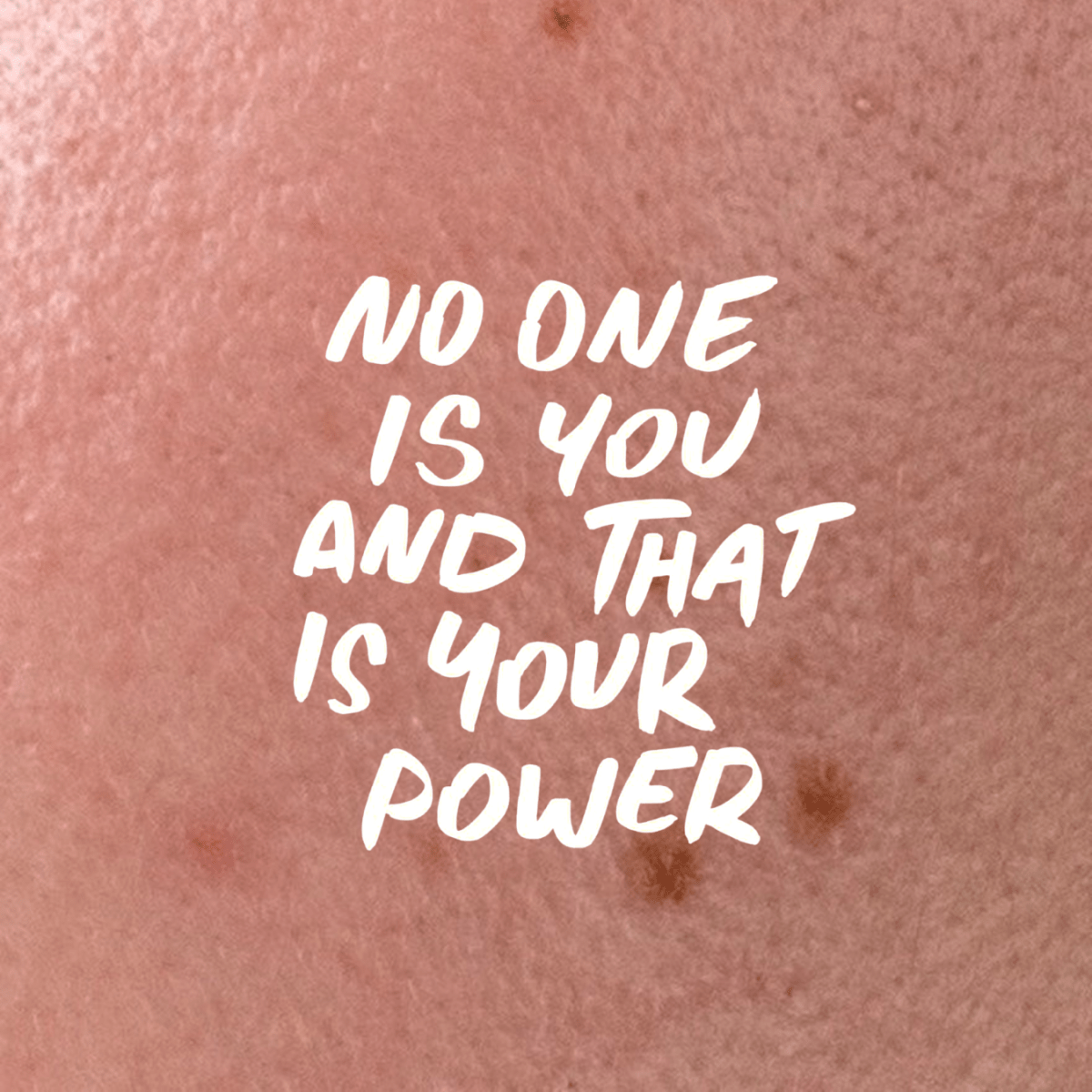 Share Your SKIN STORY with&nbsp;@itch_n_bitch