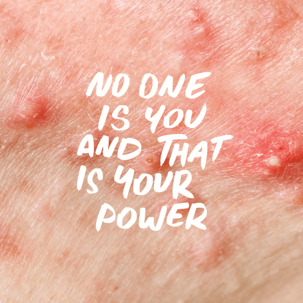 if you can’t change it, change the way you think about&nbsp;it