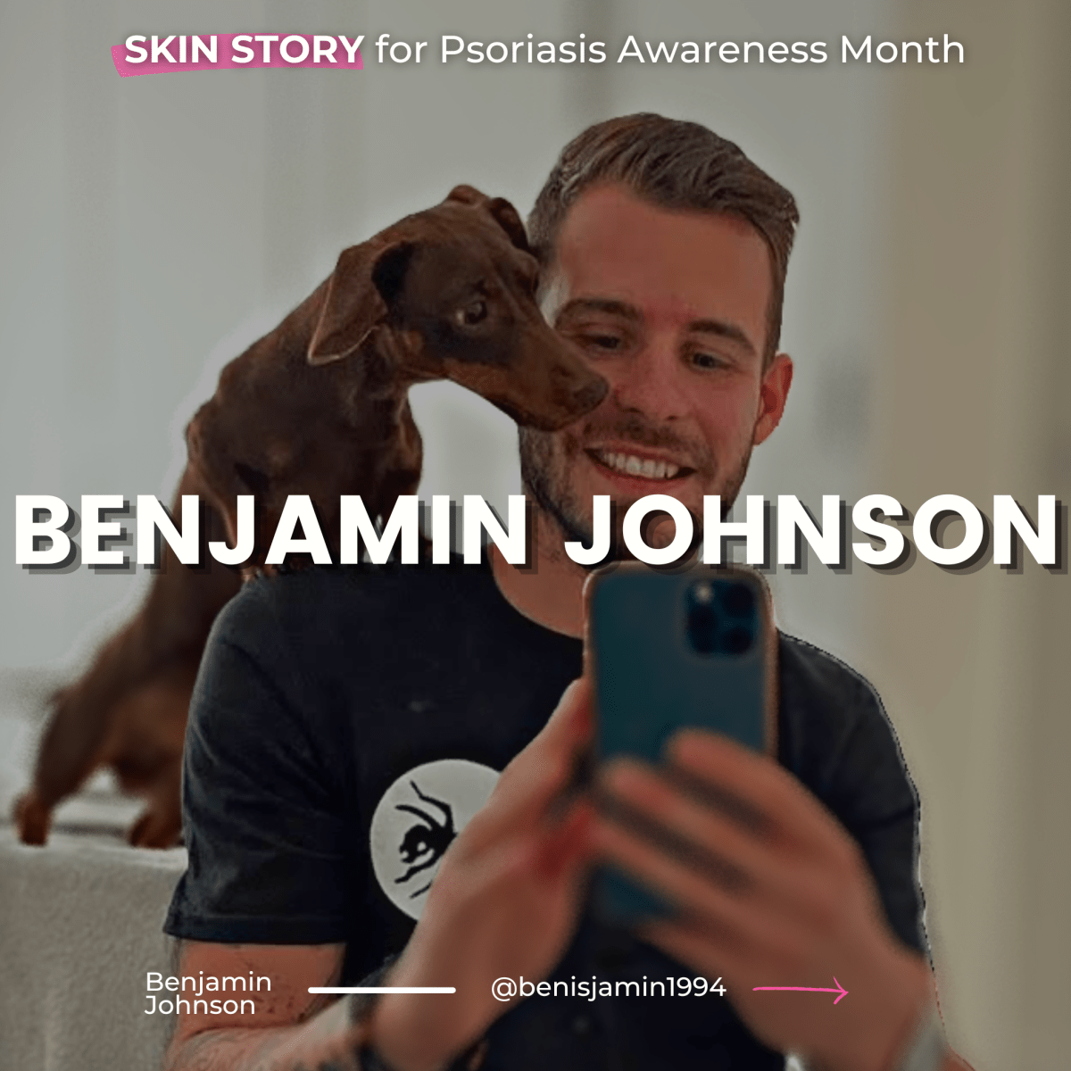 Benjamin’s SKIN STORY – sharing for #PsoriasisAwarenessMonth