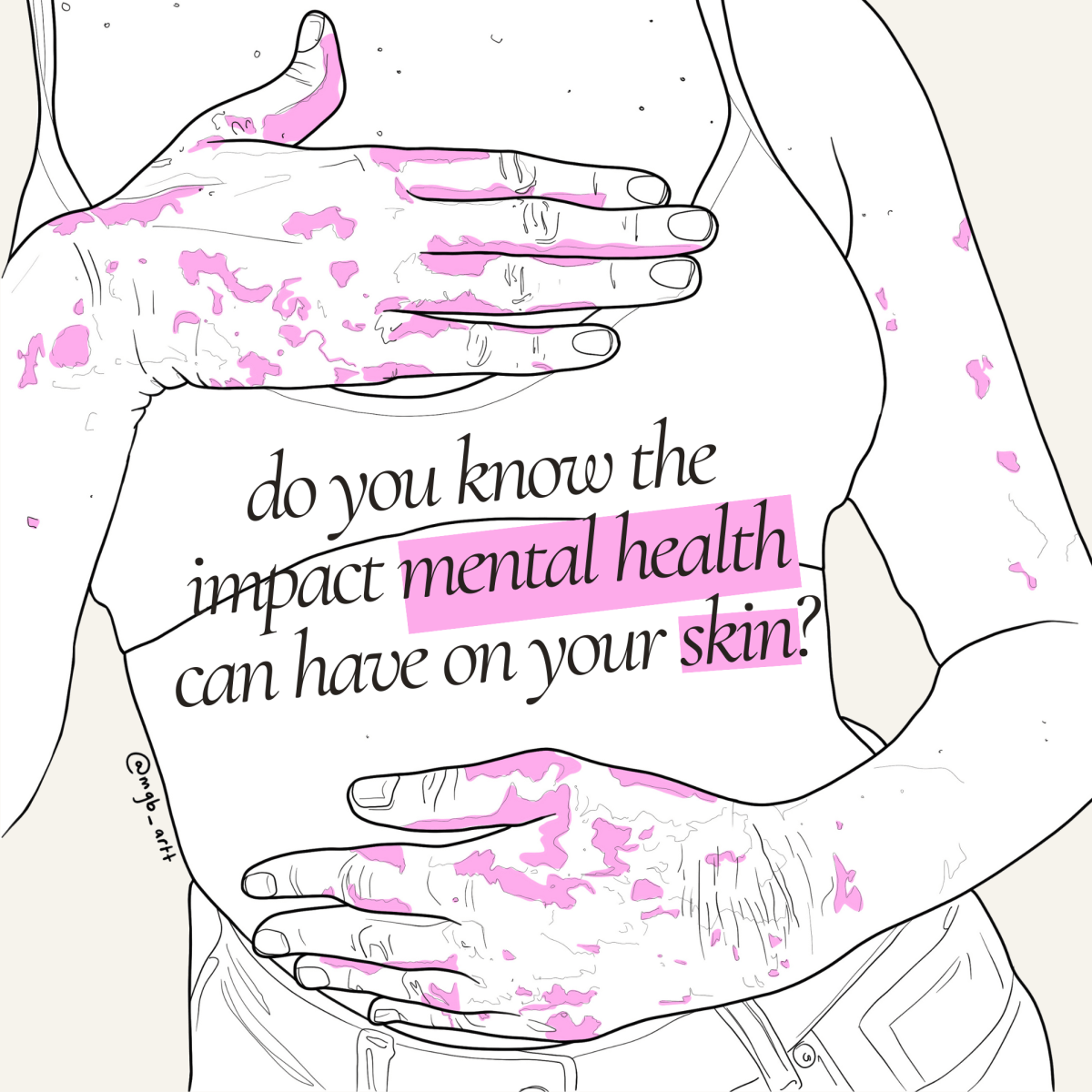 #EczemaAwarenessWeek : “It’s hard to let anyone love you, look at you, kiss you etc. when you feel and look&nbsp;disgusting.”
