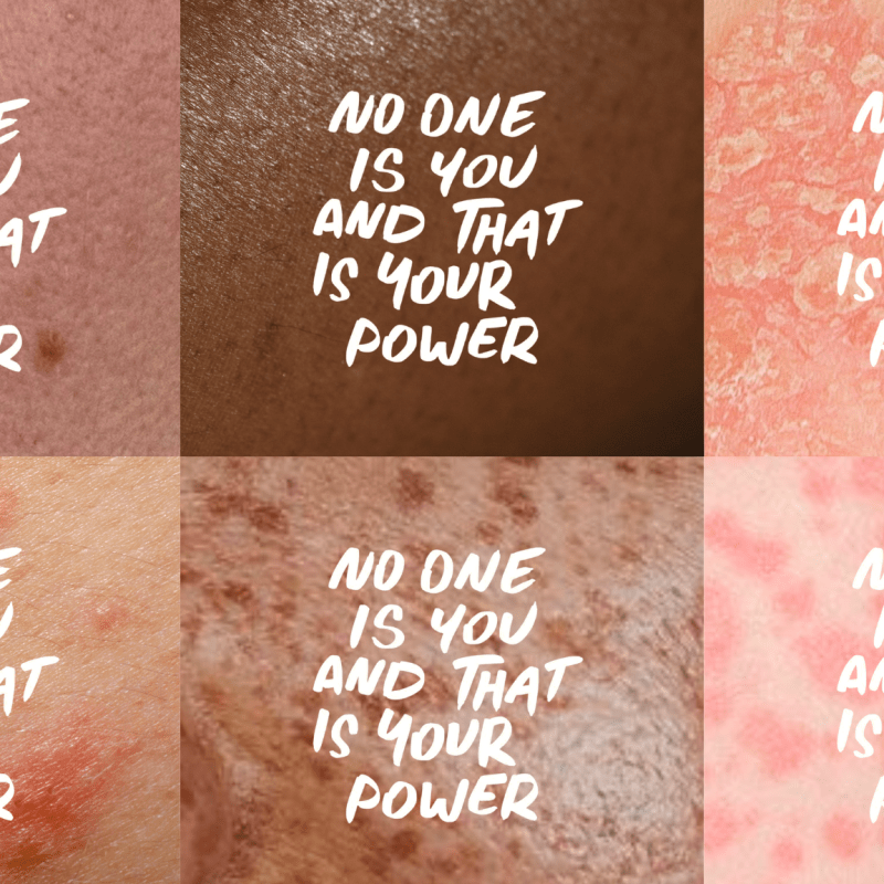 Sign up for Awareness&nbsp;opportunities