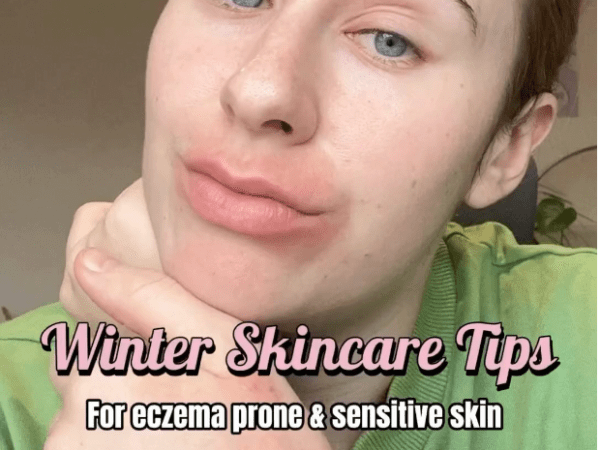 Winter Skincare Tips for Eczema-Prone and Sensitive&nbsp;Skin