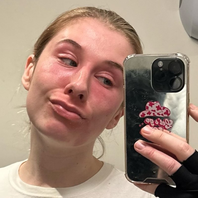 Itchy women, empower itchy women 👌🏻 