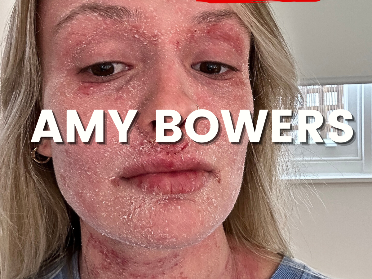 Amy Bowers✨ AKA @amy_does_tsw shares her SKIN STORY