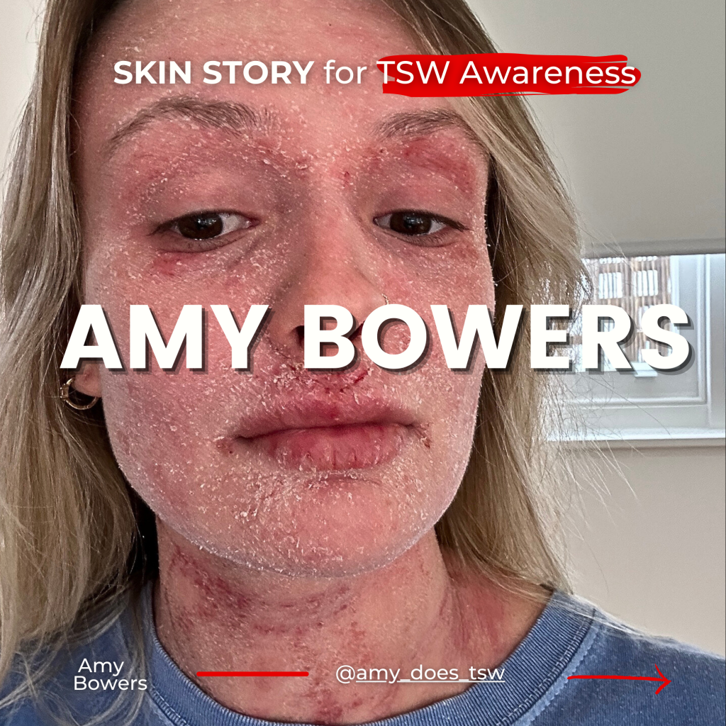 Amy Bowers✨ AKA @amy_does_tsw shares her SKIN STORY