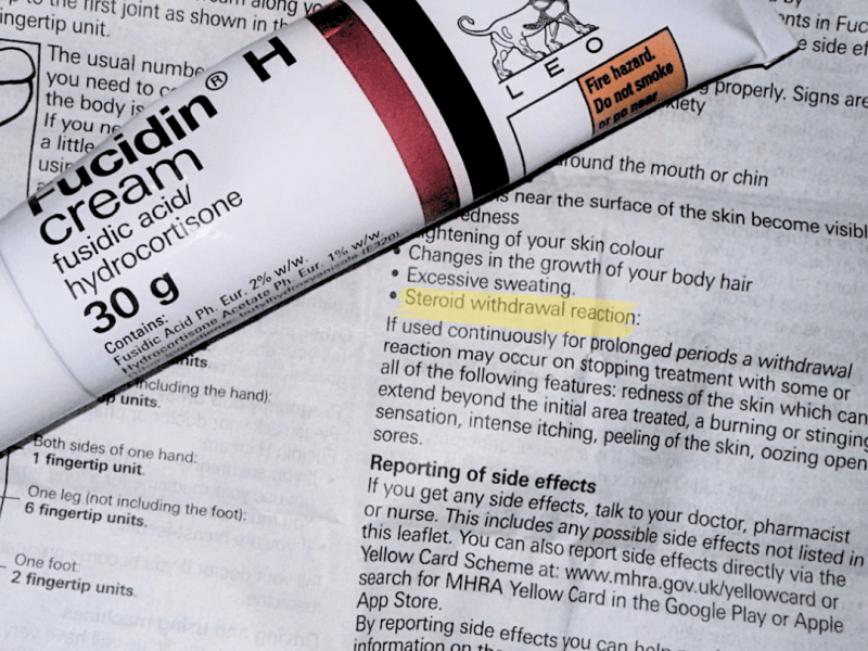 TSW is NOT&nbsp;eczema