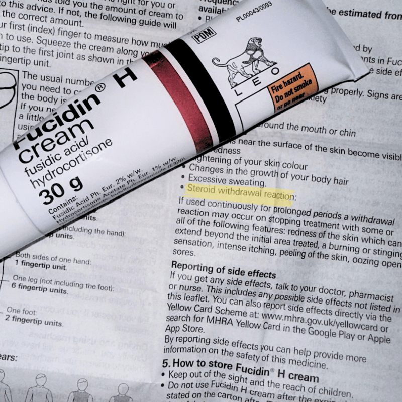 TSW is NOT&nbsp;eczema