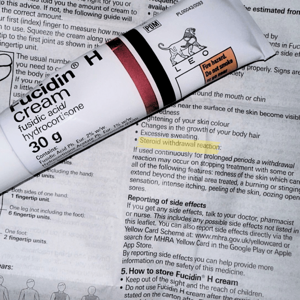 TSW is NOT&nbsp;eczema