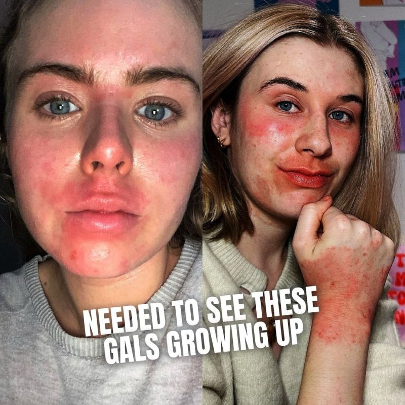 📣REAL REPRESENTATION MATTERS❤️‍🩹