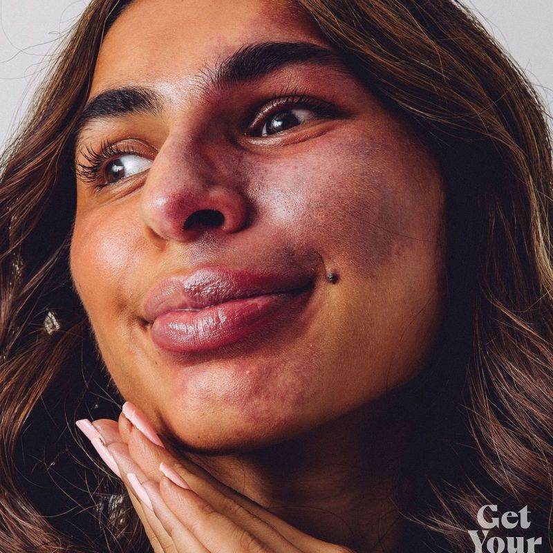 ITCHY SKIN IS IN!!🔊REAL SKIN pop-up photo exhibition at Peckham Arches this Saturday, August&nbsp;24th