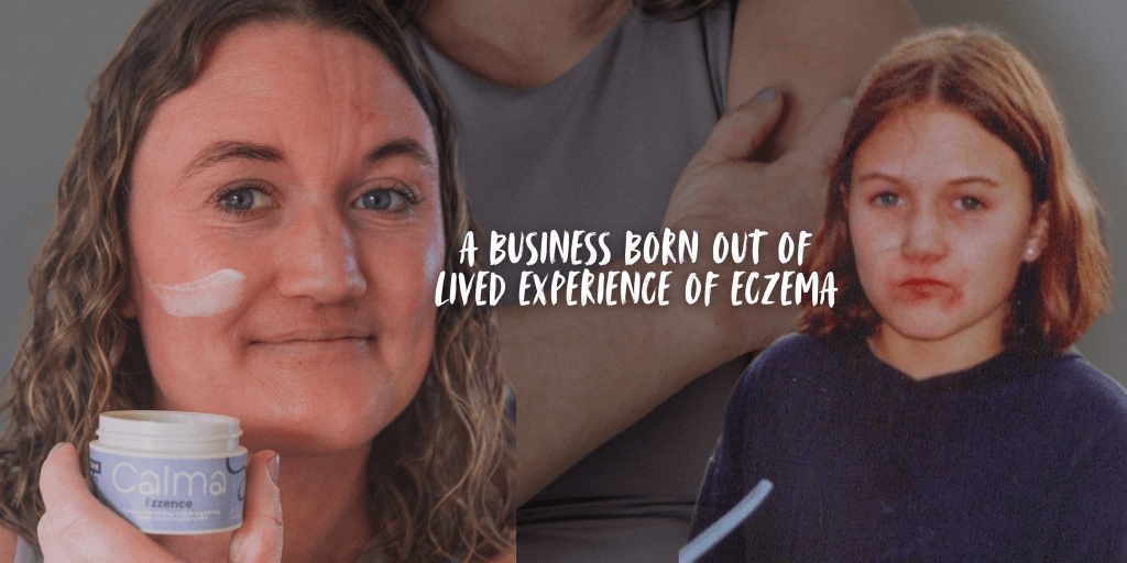 SKIN STORY: Janna Kuhl AKA&nbsp;@CalmaWithJanna