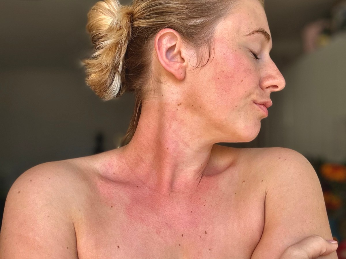 ALLERGY SEASON + ECZEMA: How Cleaner Air Transformed My Skin, Sleep, and Allergy&nbsp;Management